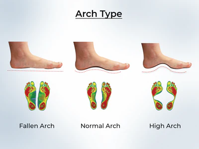 Foot Arch
